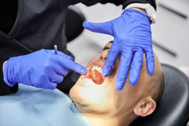 Best Emergency Dental Care for Broken or Chipped Teeth in North Westport, MA