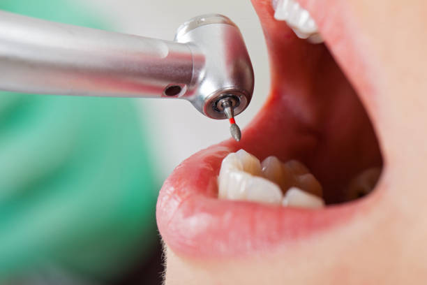 Best Emergency Treatment for Dental Infections or Abscesses in North Westport, MA